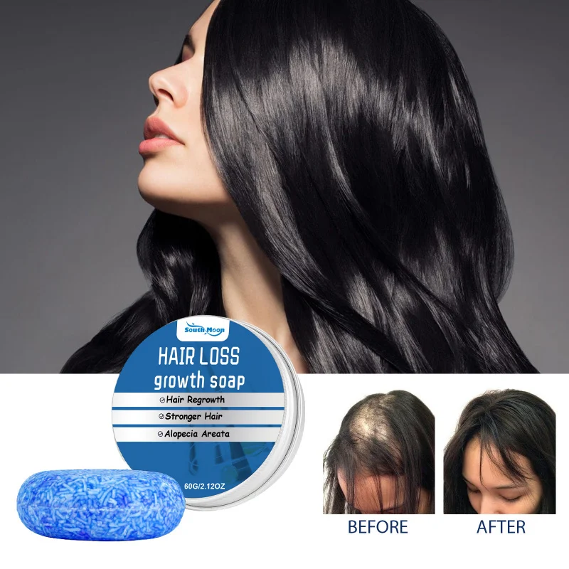 Ginger Shampoo Bar - Hair Strengthening & Scalp Care, Helps Reduce Hair Loss for Fuller Looking Hair, Natural Formula
Ginger Shampoo Bar - Hair Strengthening & Scalp Care, Helps Reduce Hair Loss for Fuller Looking Hair, Natural Formula