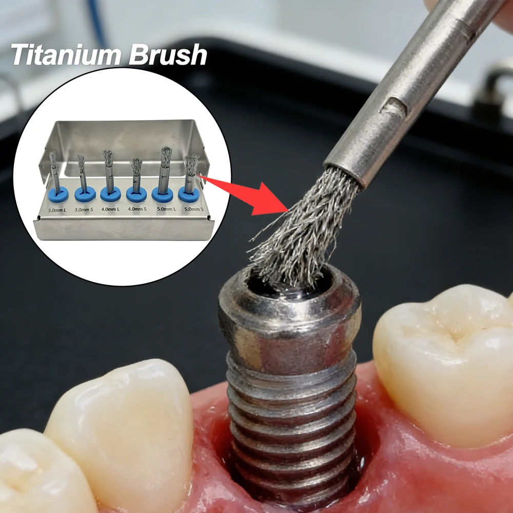 6PCS High Quality Titanium Dental Brushes for Implant Surface Cleaning Peri Implantitis Debridement Autoclavable
6PCS High Quality Titanium Dental Brushes for Implant Surface Cleaning Peri Implantitis Debridement Autoclavable