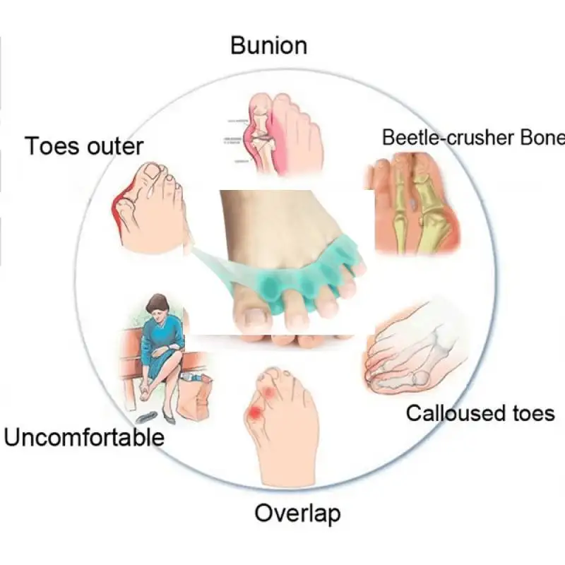 1/5/10Pairs Silicone Toe Separator Fingers Feet Spreader Hallux Valgus Bunion Corrector Straightener Corrector Finger Separator
1/5/10Pairs Silicone Toe Separator Fingers Feet Spreader Hallux Valgus Bunion Corrector Straightener Corrector Finger Separator