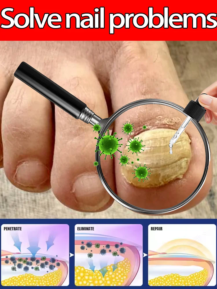 Sᴜᴍᴍᴇʀ's sᴇᴄʀᴇᴛ ᴡᴇᴀᴘᴏɴ ᴍᴀᴋᴇs ʏᴏᴜʀ ғᴇᴇᴛ ʙᴇᴀᴜᴛɪғᴜʟ ᴀɴᴅ ʏᴏᴜʀ ᴛʀᴏᴜʙʟᴇs ᴅɪsᴀᴘ 
Sᴜᴍᴍᴇʀ's sᴇᴄʀᴇᴛ ᴡᴇᴀᴘᴏɴ ᴍᴀᴋᴇs ʏᴏᴜʀ ғᴇᴇᴛ ʙᴇᴀᴜᴛɪғᴜʟ ᴀɴᴅ ʏᴏᴜʀ ᴛʀᴏᴜʙʟᴇs ᴅɪsᴀᴘ