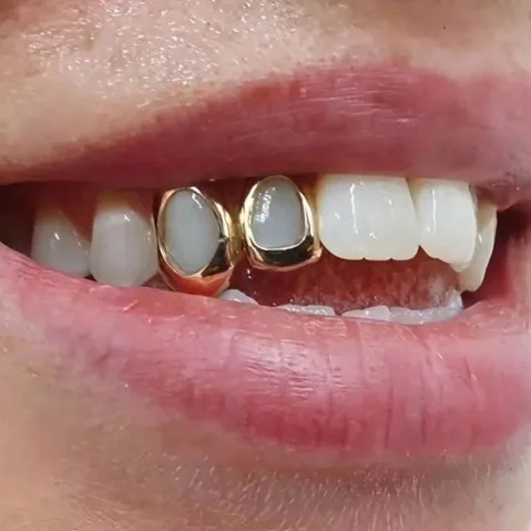 Temu explosion double hollow smooth surface upgrade 18K hip hop braces halloween decorative jewelry teeth grills
Temu explosion double hollow smooth surface upgrade 18K hip hop braces halloween decorative jewelry teeth grills