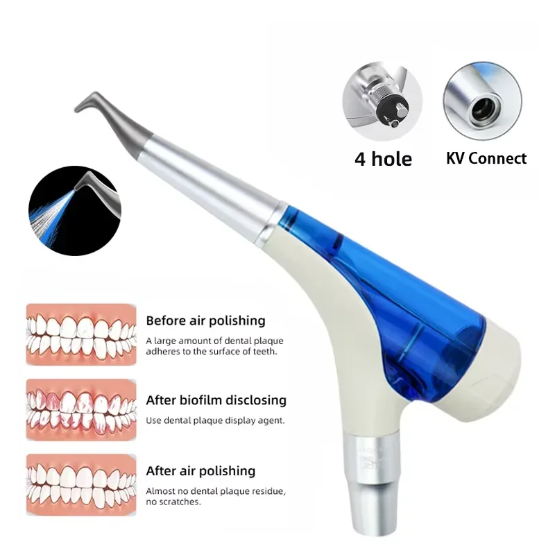 Стоматологический воздушный полировщик для Supragingival Cleaning Air Prophy Jet Очистка зубного камня Стоматологический инструмент
Стоматологический воздушный полировщик для Supragingival Cleaning Air Prophy Jet Очистка зубного камня Стоматологический инструмент