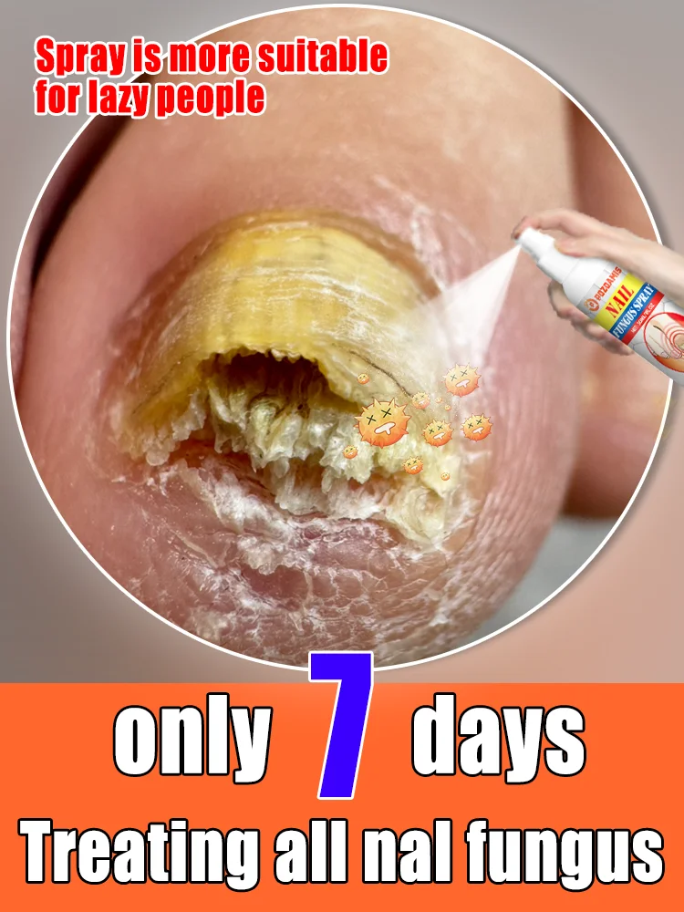 The most powerful black technology in 2025,ᵉᶠᶠᵉᶜᵗⁱᵛᵉ ⁿᵃⁱˡ ᶠᵘⁿᵍᵘˢ ᵗʳᵉᵃᵗᵐᵉⁿᵗ⸴ ʳᵉˢᵗᵒʳᵉ ⁿᵃⁱˡ 
The most powerful black technology in 2025,ᵉᶠᶠᵉᶜᵗⁱᵛᵉ ⁿᵃⁱˡ ᶠᵘⁿᵍᵘˢ ᵗʳᵉᵃᵗᵐᵉⁿᵗ⸴ ʳᵉˢᵗᵒʳᵉ ⁿᵃⁱˡ