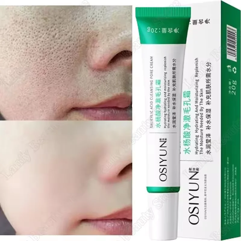 Крем для очищения пор с салициловой кислотой, сужение пор, удаление черных точек, прыщей, осветление, увлажнение, уход за гладкой кожей, корейские товары
Крем для очищения пор с салициловой кислотой, сужение пор, удаление черных точек, прыщей, осветление, увлажнение, уход за гладкой кожей, корейские товары