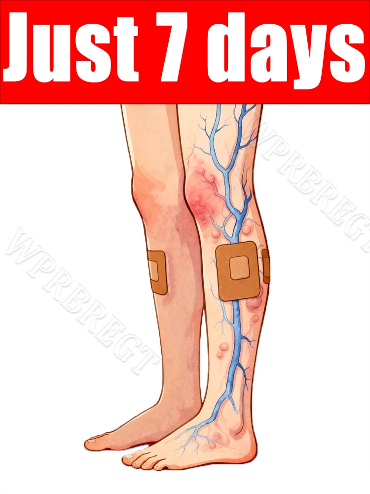 Oɴᴇ ᴘᴀᴛᴄʜ ɪs ᴀʟʟ ɪᴛ ᴛᴀᴋᴇs ᴛᴏ ᴄᴏᴍᴘʟᴇᴛᴇʟʏ sᴏʟᴠᴇ ᴠᴀʀɪᴄᴏsᴇ ᴠᴇɪɴ ᴘʀᴏʙʟᴇᴍs.
Oɴᴇ ᴘᴀᴛᴄʜ ɪs ᴀʟʟ ɪᴛ ᴛᴀᴋᴇs ᴛᴏ ᴄᴏᴍᴘʟᴇᴛᴇʟʏ sᴏʟᴠᴇ ᴠᴀʀɪᴄᴏsᴇ ᴠᴇɪɴ ᴘʀᴏʙʟᴇᴍs.