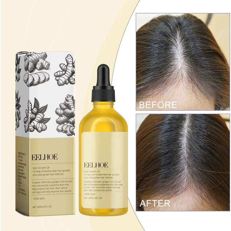 Ginger Hair Oil - Nourishing Treatment for Dry Damaged Hair, Helps Improve Scalp Health & Shine, Lightweight Formula
Ginger Hair Oil - Nourishing Treatment for Dry Damaged Hair, Helps Improve Scalp Health & Shine, Lightweight Formula