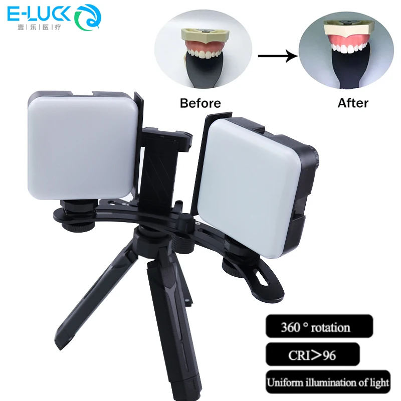 Свет для стоматологической фотографии, мобильная фотография, светодиодный светильник, Bluetooth, внутриротовое фото для стоматолога, ламповое оборудование
Свет для стоматологической фотографии, мобильная фотография, светодиодный светильник, Bluetooth, внутриротовое фото для стоматолога, ламповое оборудование