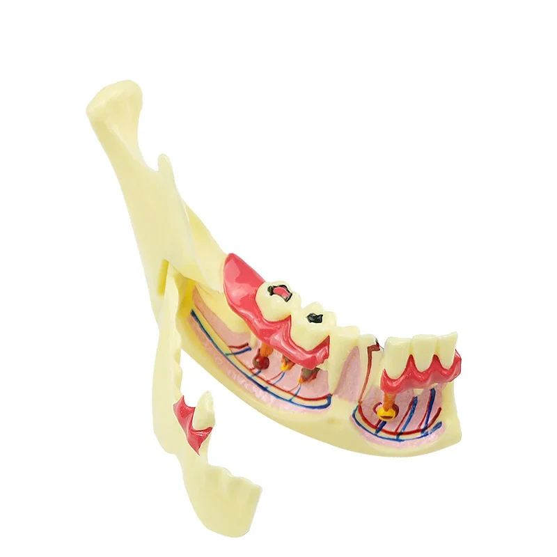 Dental Endodontic Treatment Model Anatomical Model Teaching Studying Model Dental Materials 
Dental Endodontic Treatment Model Anatomical Model Teaching Studying Model Dental Materials