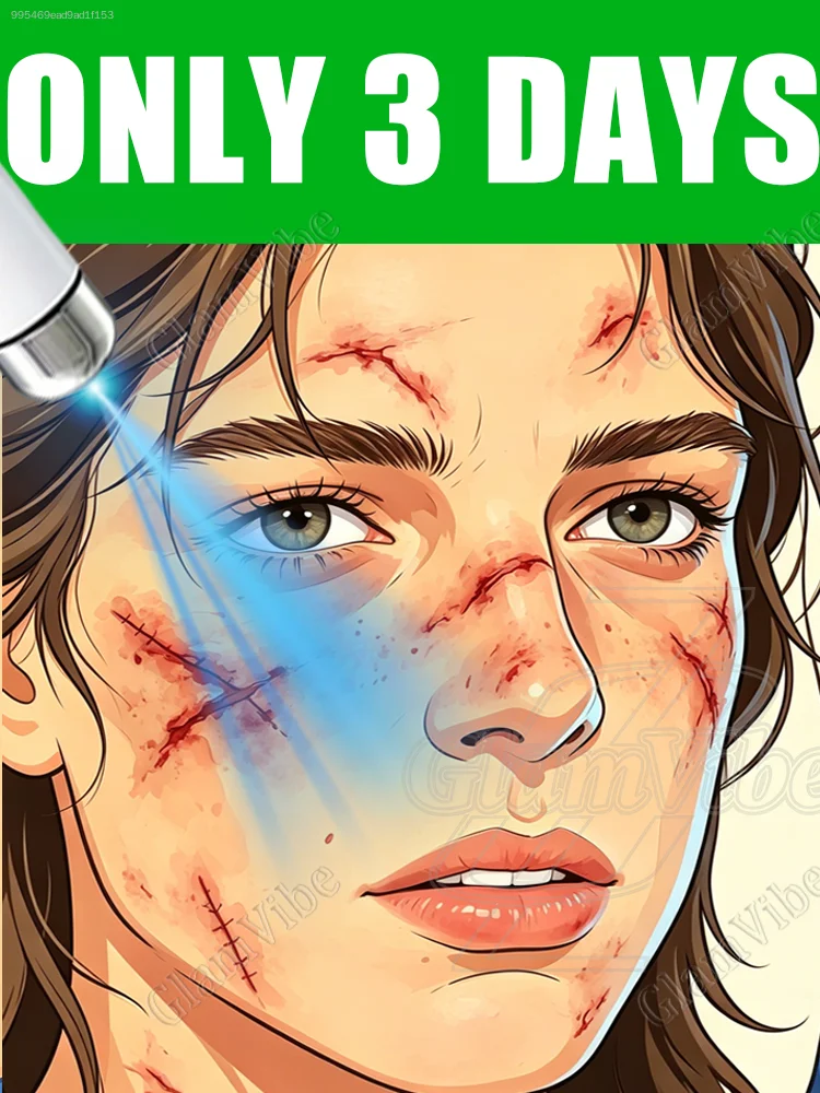 Rᴀᴘɪᴅ Rᴇᴍᴏᴠᴀʟ | 830ɴᴍ Lɪɢʜᴛᴡᴀᴠᴇ Cᴀʀᴇ | Safe & Pain-Free | The Premier Choice for Daily Repair54*-/749647/*
Rᴀᴘɪᴅ Rᴇᴍᴏᴠᴀʟ | 830ɴᴍ Lɪɢʜᴛᴡᴀᴠᴇ Cᴀʀᴇ | Safe & Pain-Free | The Premier Choice for Daily Repair54*-/749647/*