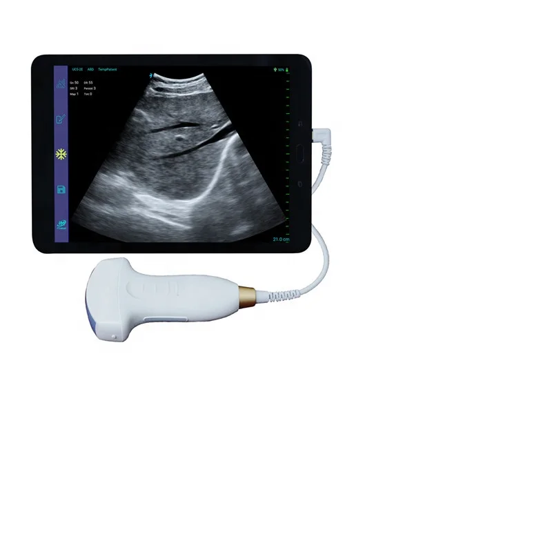 USB Probe linear convex for android laptop PC Factory Price Portable Ultrasound/USB
USB Probe linear convex for android laptop PC Factory Price Portable Ultrasound/USB