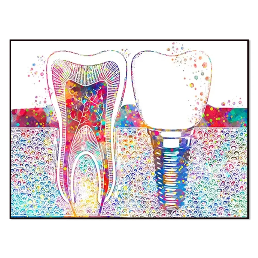 Dental Art Picture Tooth Implant Canvas Print Dentist Wall Art Painting Medicine Hygienist Poster Tooth Clinic Decor
Dental Art Picture Tooth Implant Canvas Print Dentist Wall Art Painting Medicine Hygienist Poster Tooth Clinic Decor