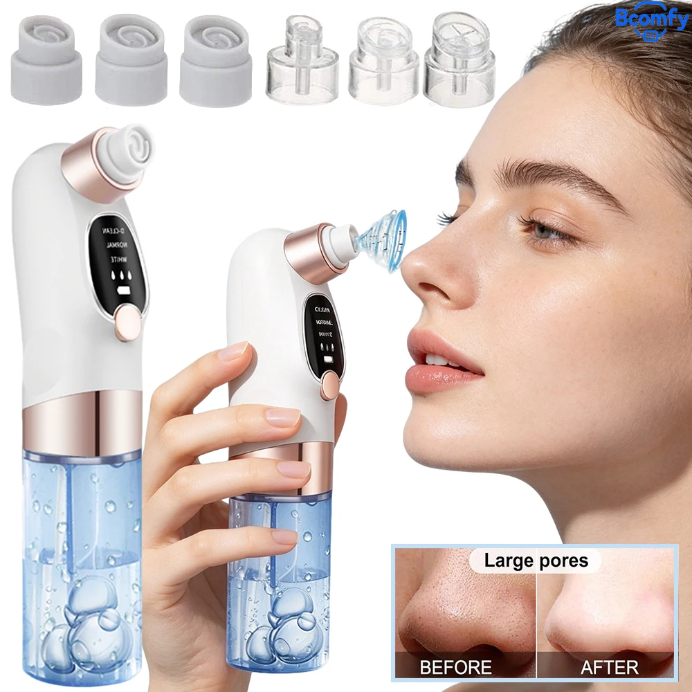 Electric Blackhead Remover Portable Vacuum Facial Pore Cleaner Deep Dirt Rechargeable Skin Cleaning Machine Skin Care Tool
Electric Blackhead Remover Portable Vacuum Facial Pore Cleaner Deep Dirt Rechargeable Skin Cleaning Machine Skin Care Tool