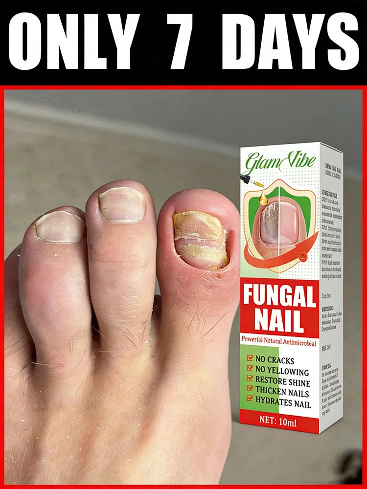 Break away from dry chapped cuticles, fingertips stay moist nourished
Break away from dry chapped cuticles, fingertips stay moist nourished