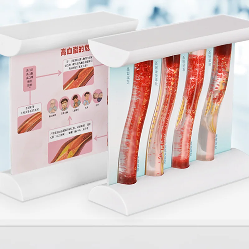 Dynamic Atherosclerosis Lipoprotein Blood Vessel Model for Medical Paitent Doctor Teaching
Dynamic Atherosclerosis Lipoprotein Blood Vessel Model for Medical Paitent Doctor Teaching