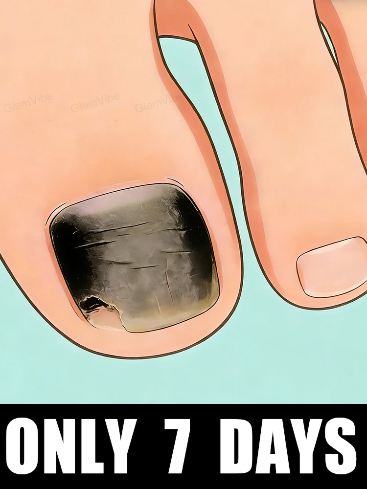 New 2026 Offer! Free Shipping! Tea Tree Nail Solution 10ml
New 2026 Offer! Free Shipping! Tea Tree Nail Solution 10ml