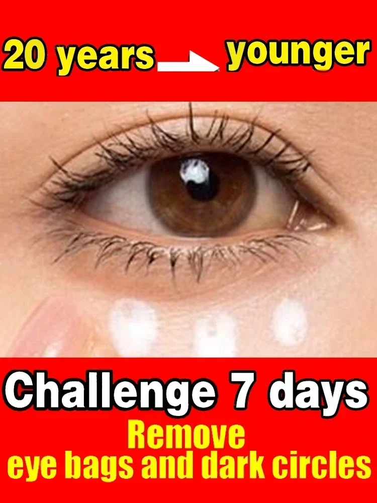 Eye Bag Cream 7 Days Anti Wrinkle Remove Puffiness Dark Circles Puffiness Firming Smooth Skin Care Moisturising Massage Cream
Eye Bag Cream 7 Days Anti Wrinkle Remove Puffiness Dark Circles Puffiness Firming Smooth Skin Care Moisturising Massage Cream