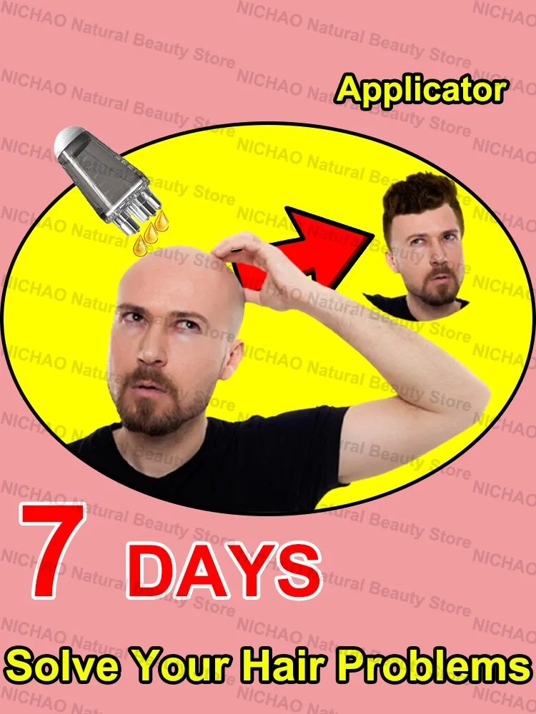 7 Days Fast Hair Growth Essential Loss Regrowth Treatment Strengthens Hair Nourishes Scalp Light Weight Non Greasy
7 Days Fast Hair Growth Essential Loss Regrowth Treatment Strengthens Hair Nourishes Scalp Light Weight Non Greasy