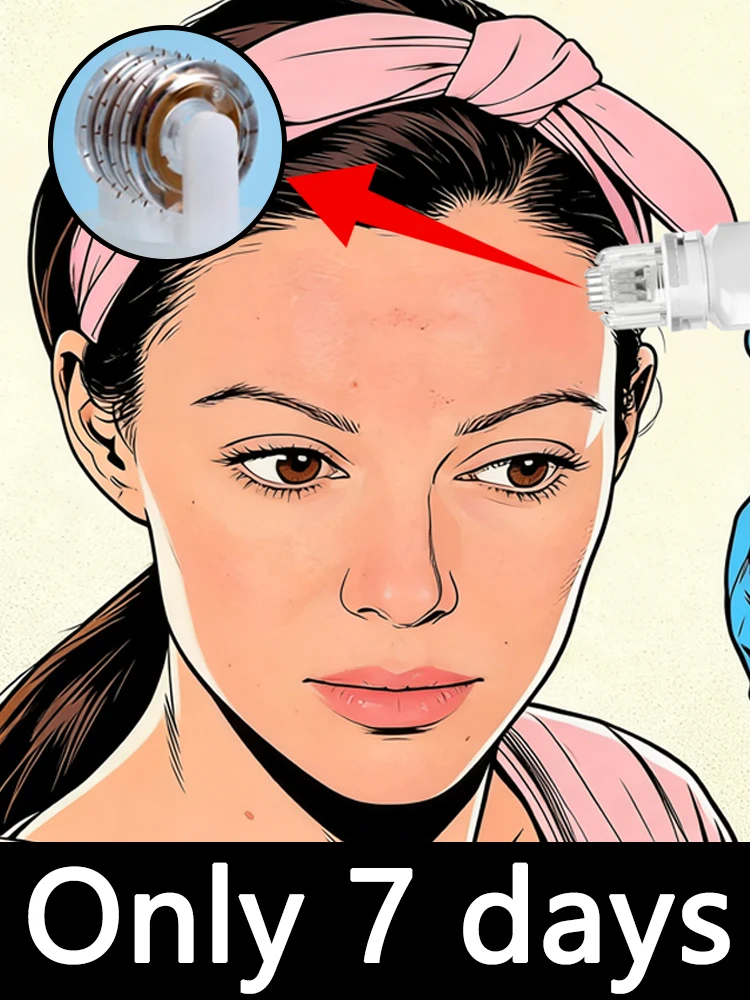 Microneedling Set ≤0.1mm, Reduce wrinkles and shrink pores, solves your skin problems in 7 days,Free shipping.
Microneedling Set ≤0.1mm, Reduce wrinkles and shrink pores, solves your skin problems in 7 days,Free shipping.