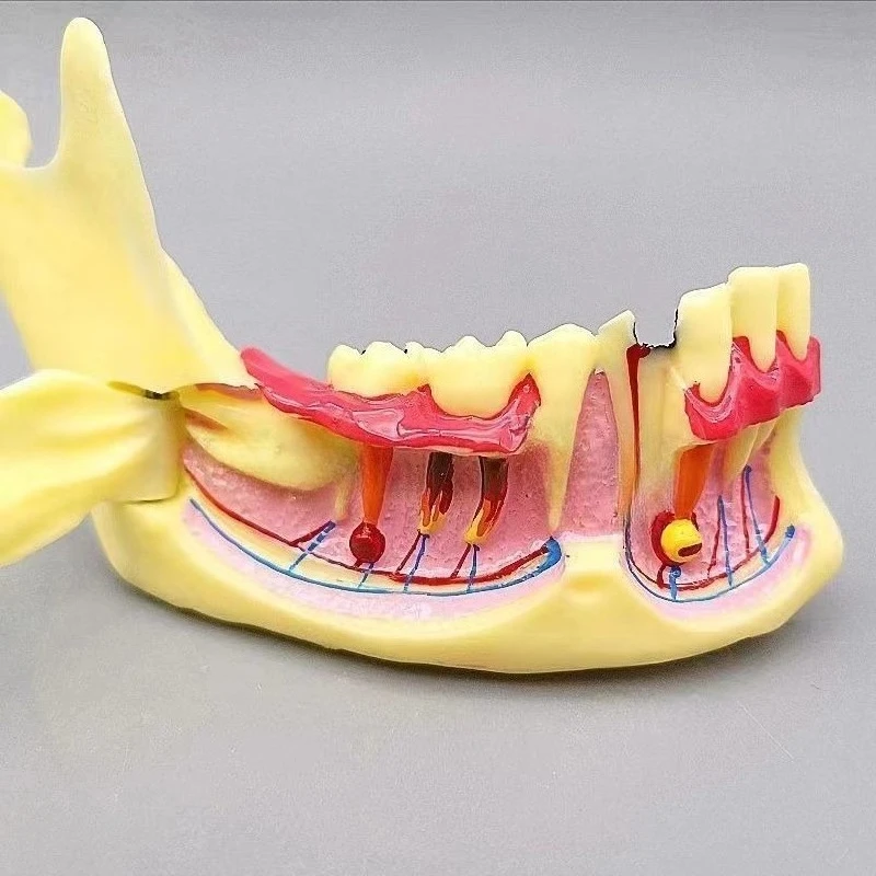 1pc Dental Gums Mandible Tissue Anatomical Model Dental Endodontic Treatment Teeth Model Dentist Teach Study Demonstration Tool
1pc Dental Gums Mandible Tissue Anatomical Model Dental Endodontic Treatment Teeth Model Dentist Teach Study Demonstration Tool