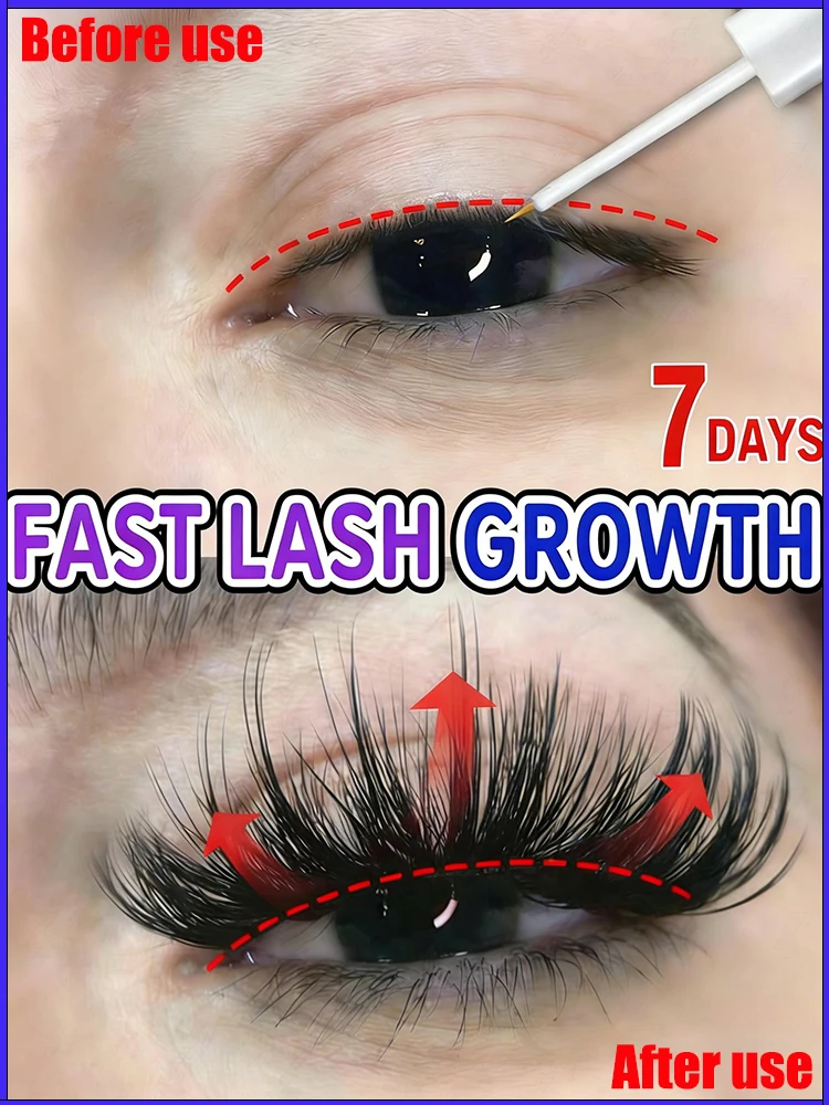 Rᴀᴘɪᴅ Eɴʜᴀɴᴄᴇʀ ғᴏʀ Sᴘᴀʀsᴇ Lᴀsʜᴇs Bʀᴏᴡs, Tʀᴀᴠᴇʟ-Fʀɪᴇɴᴅʟʏ Sɪᴢᴇ
Rᴀᴘɪᴅ Eɴʜᴀɴᴄᴇʀ ғᴏʀ Sᴘᴀʀsᴇ Lᴀsʜᴇs Bʀᴏᴡs, Tʀᴀᴠᴇʟ-Fʀɪᴇɴᴅʟʏ Sɪᴢᴇ