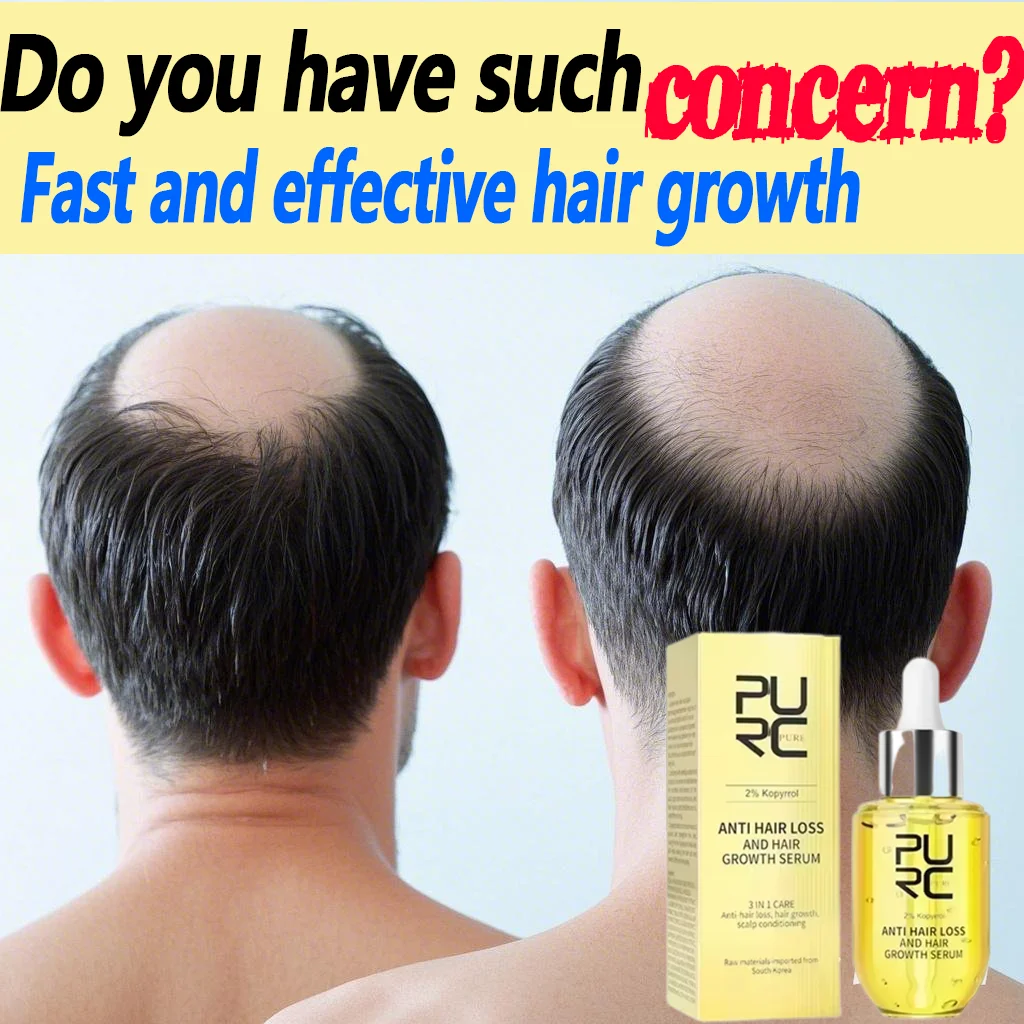 Fast and effective hair growth essential oil Awakening hair follicles restore thick hair say goodbye to baldness
Fast and effective hair growth essential oil Awakening hair follicles restore thick hair say goodbye to baldness
