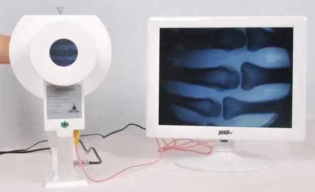 Portable X-ray Fluoroscopy Machine BJI-2J Low Dose X-ray Fluoroscopy Used for Portable x-Ray machine made in China
Portable X-ray Fluoroscopy Machine BJI-2J Low Dose X-ray Fluoroscopy Used for Portable x-Ray machine made in China
