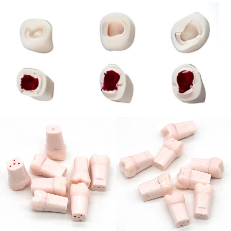 13 Type Dental Endodontic Teeth Model White Root Canal Pulp Cavity Medullary Endo Study Training Practice Block
13 Type Dental Endodontic Teeth Model White Root Canal Pulp Cavity Medullary Endo Study Training Practice Block