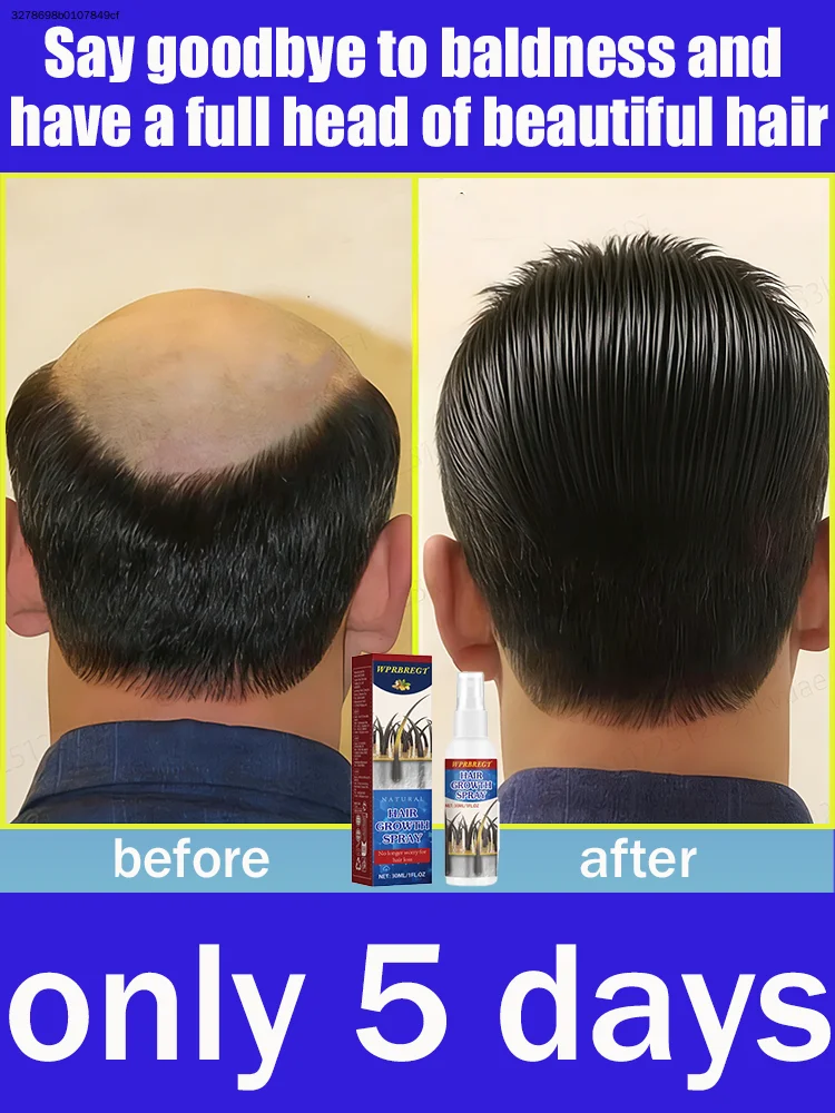 ᴘʀᴏᴛᴇᴄᴛs ᴀɴᴅ sᴛʀᴇɴɢᴛʜᴇɴs ʜᴀɪʀ ʀᴏᴏᴛs, ᴘʀᴏᴍᴏᴛɪɴɢ sᴄᴀʟᴘ ʜᴇᴀʟᴛʜ.ʰᵃⁱʳᵍ ʳᵒʷᵗʰ
ᴘʀᴏᴛᴇᴄᴛs ᴀɴᴅ sᴛʀᴇɴɢᴛʜᴇɴs ʜᴀɪʀ ʀᴏᴏᴛs, ᴘʀᴏᴍᴏᴛɪɴɢ sᴄᴀʟᴘ ʜᴇᴀʟᴛʜ.ʰᵃⁱʳᵍ ʳᵒʷᵗʰ