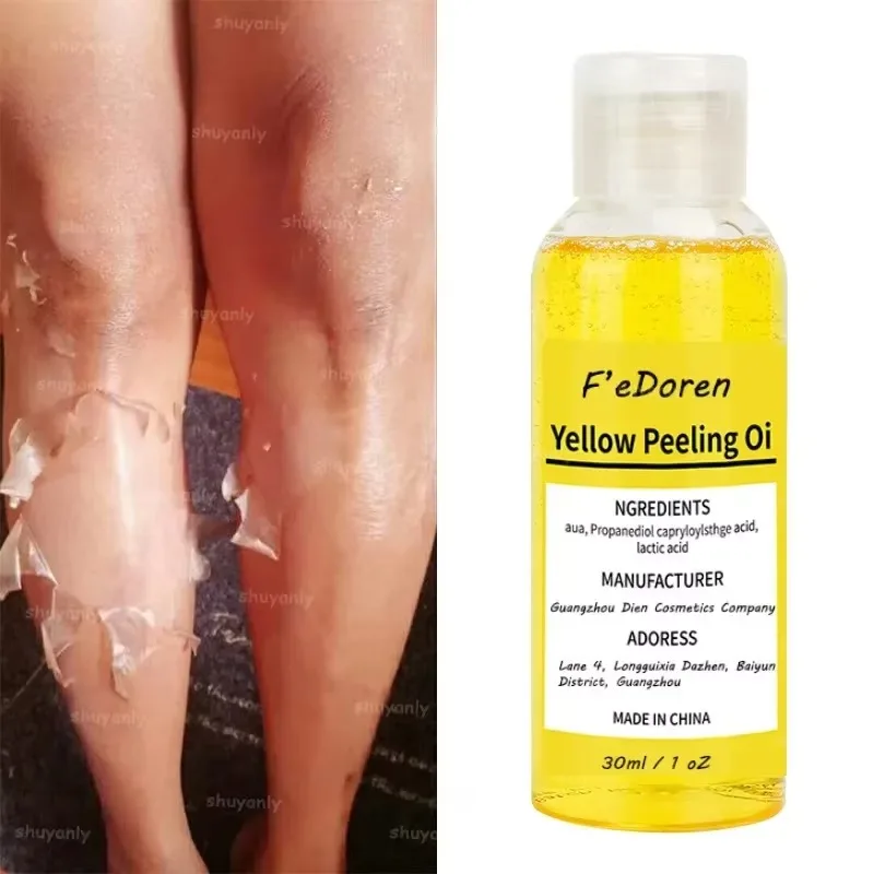 Yellow Exfoliating Oil Is Suitable for Dark Skin. Strong Exfoliating Oil Brightens The Skin, Moisturizes and Lightens Melanin
Yellow Exfoliating Oil Is Suitable for Dark Skin. Strong Exfoliating Oil Brightens The Skin, Moisturizes and Lightens Melanin