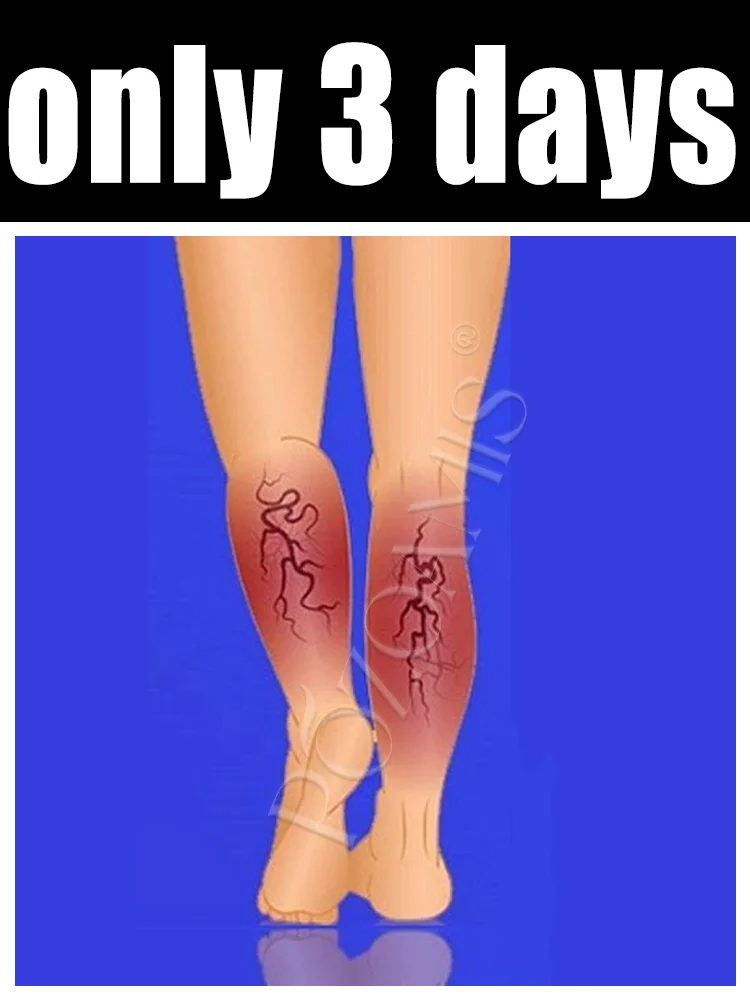 Популярные товары в 2025 году: Массажные инструменты, облегчение боли в ногах. 
Популярные товары в 2025 году: Массажные инструменты, облегчение боли в ногах.