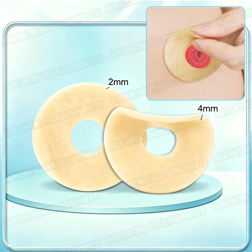 10-50Pcs Colostomy Bag Anti-leak Ring Paste Stoma Bags Anti-Leakage Protective Barrier Rings Ostomy Bag Leak Proof Sealing Cover
10-50Pcs Colostomy Bag Anti-leak Ring Paste Stoma Bags Anti-Leakage Protective Barrier Rings Ostomy Bag Leak Proof Sealing Cover