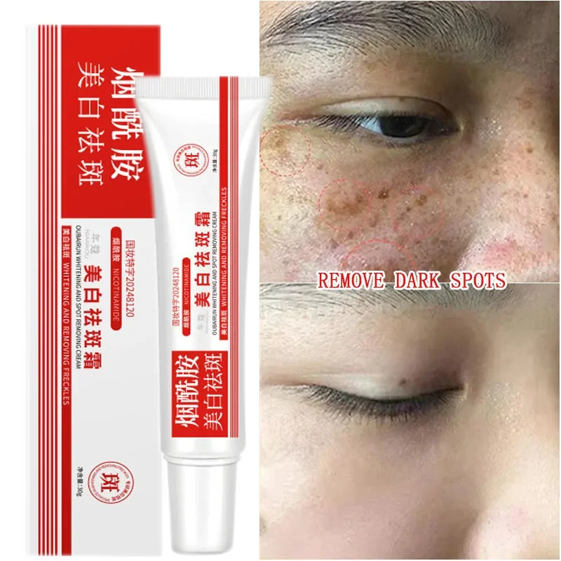 Whitening Freckle Cream Remove Dark Spots Anti Freckle Face Creams Niacinamide Fade Pigmentation Melasma Brighten Skin Care 30g 
Whitening Freckle Cream Remove Dark Spots Anti Freckle Face Creams Niacinamide Fade Pigmentation Melasma Brighten Skin Care 30g