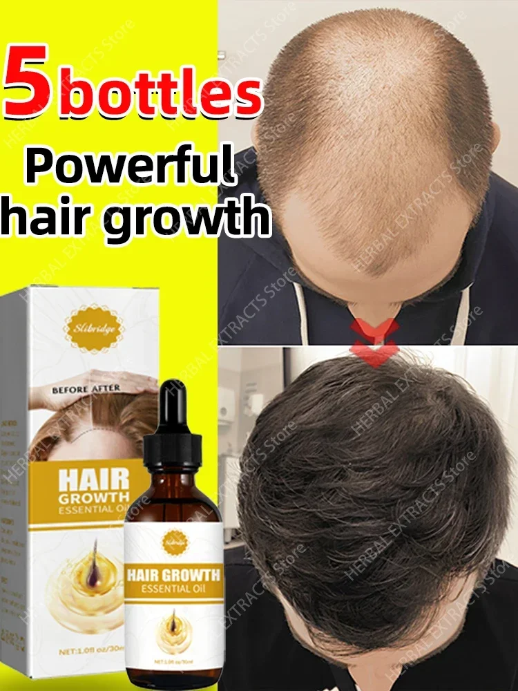 O óleo de crescimento capilar faz o cabelo crescer rapidamente, repara eficazmente a calvície e a queda de cabelo hereditária
O óleo de crescimento capilar faz o cabelo crescer rapidamente, repara eficazmente a calvície e a queda de cabelo hereditária