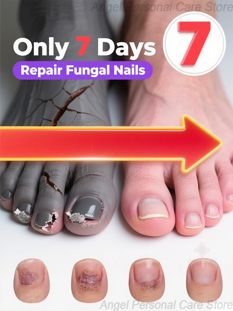 Легко проникает, гладкий и нежный, очищает торжественно и запах отлично.
Легко проникает, гладкий и нежный, очищает торжественно и запах отлично.