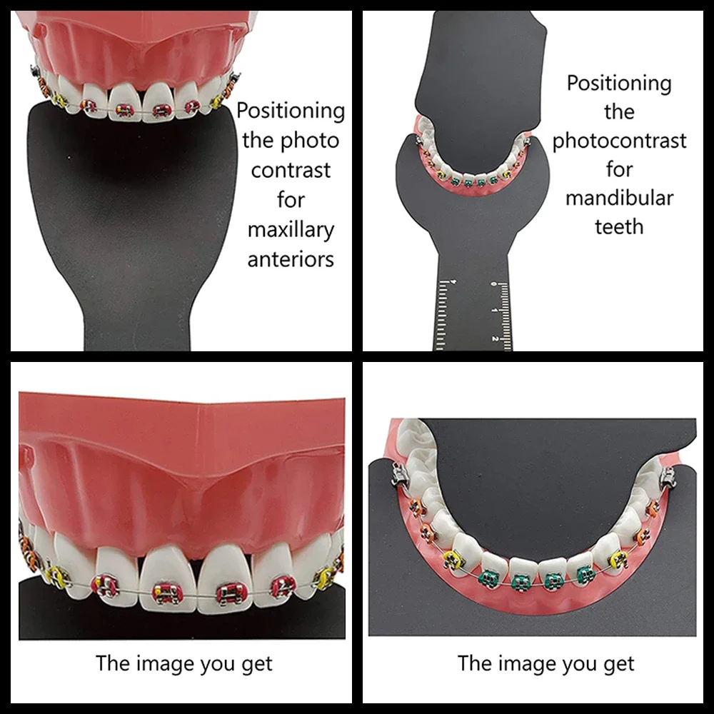 1pcs Dental Orthodontic Black Background Photo Image Contrast Board Oral Cheek Plate with Scale Mark Autoclavable Dentist Tools
1pcs Dental Orthodontic Black Background Photo Image Contrast Board Oral Cheek Plate with Scale Mark Autoclavable Dentist Tools