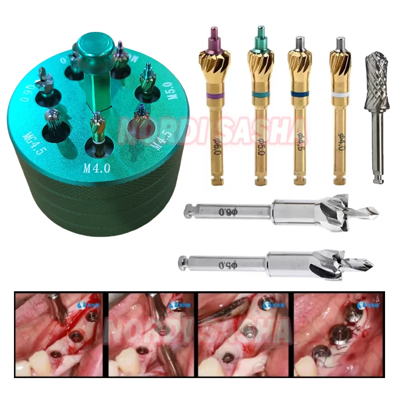 Dental Bone Grinding Drill Set Dental Implant Bone Profiler Ridge Grinding Bur Surgical Instrument Contouring Drills Trimmer
Dental Bone Grinding Drill Set Dental Implant Bone Profiler Ridge Grinding Bur Surgical Instrument Contouring Drills Trimmer