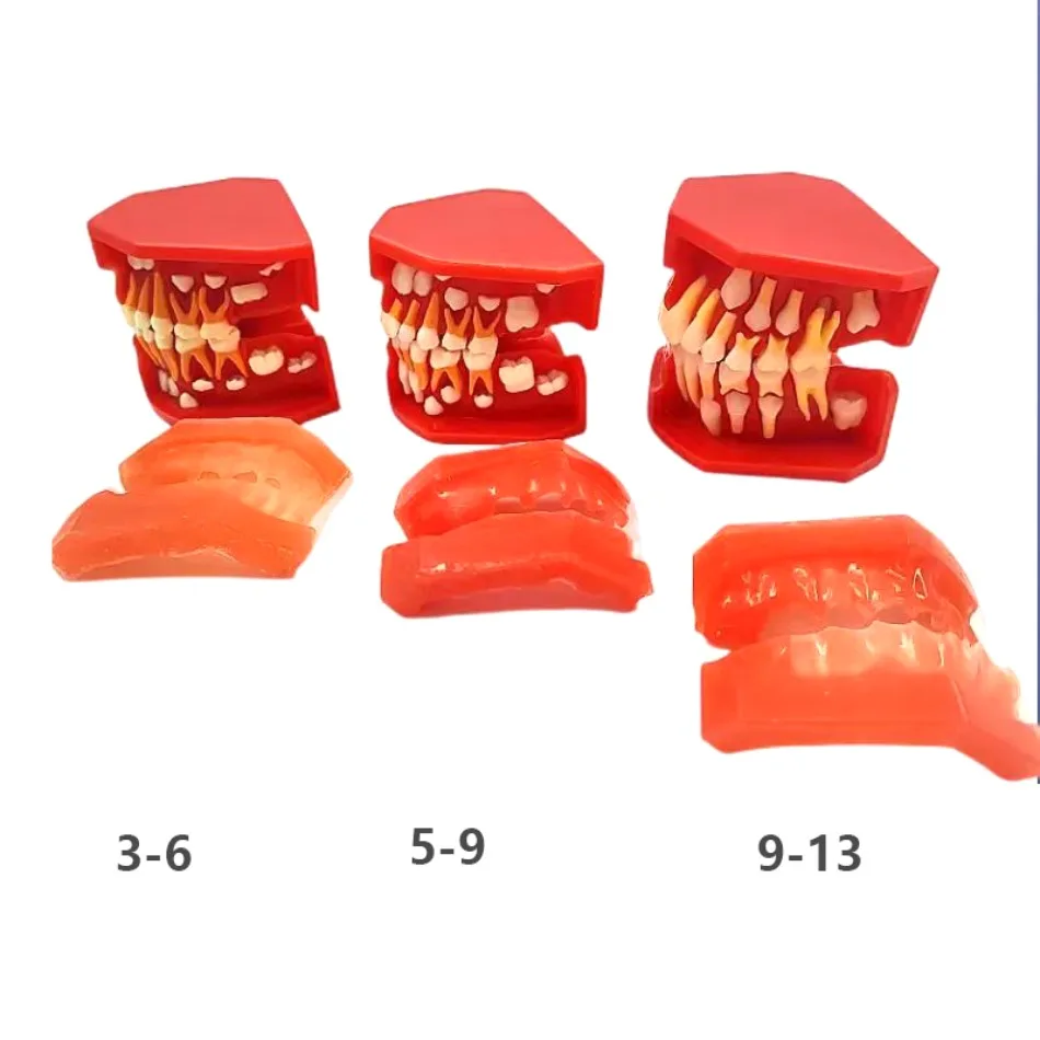 Dental Oral Children's Deciduous Tooth Replacement Model Children's Deciduous Permanent Tooth Replacement
Dental Oral Children's Deciduous Tooth Replacement Model Children's Deciduous Permanent Tooth Replacement