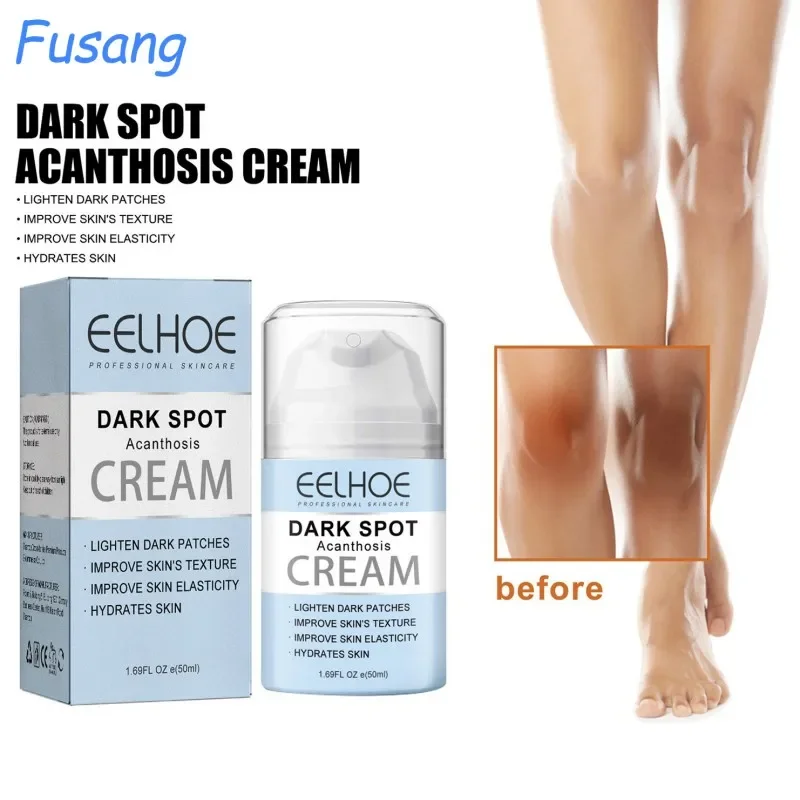Women Private Parts Brighten Cream Inner Thigh Brightening Cream Underarm Skin Bleaching Serum Lighten Butt Remove Dull Emulsion
Women Private Parts Brighten Cream Inner Thigh Brightening Cream Underarm Skin Bleaching Serum Lighten Butt Remove Dull Emulsion