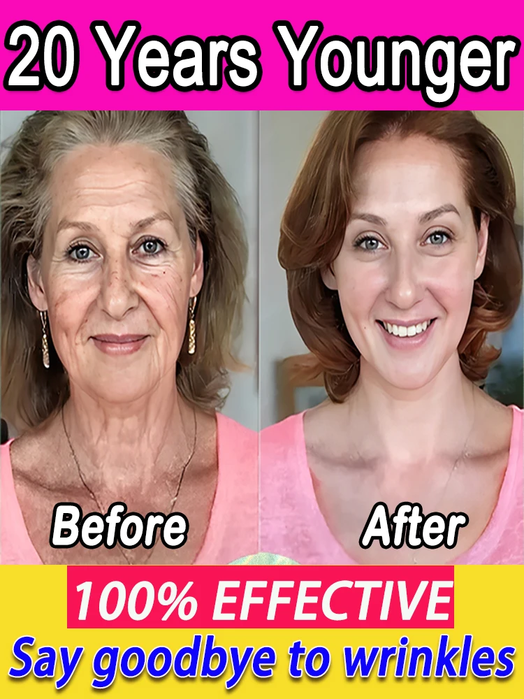 bubble skincare alo k-beauty wrinkles remover anti-wrinkle oxys cream Anti-wrinkle facial anti aging face lift skin care whiteni
bubble skincare alo k-beauty wrinkles remover anti-wrinkle oxys cream Anti-wrinkle facial anti aging face lift skin care whiteni
