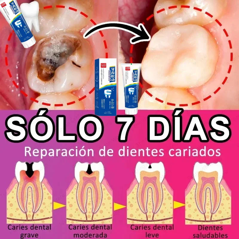 Hot selling product, 99% of buyers will buy again, teeth are getting better and better, fast effect, no more cavities
Hot selling product, 99% of buyers will buy again, teeth are getting better and better, fast effect, no more cavities