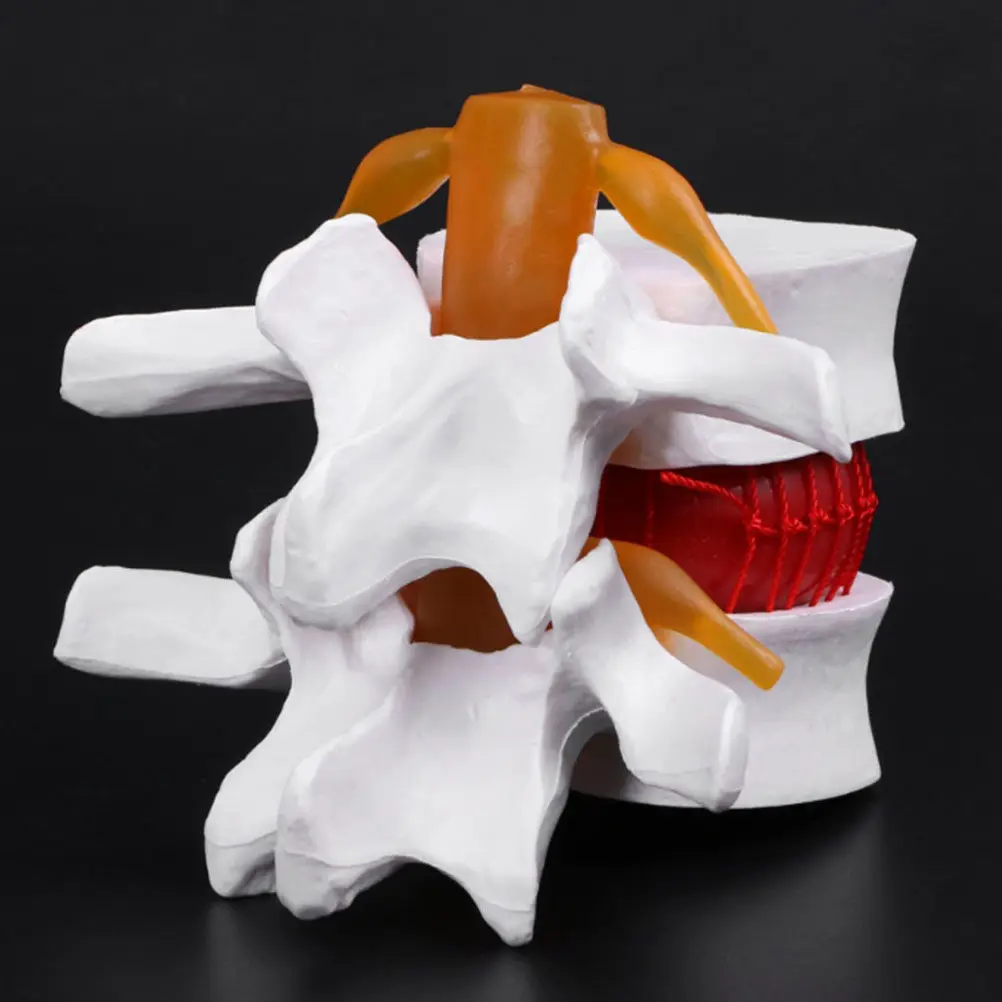 1Pcs Human Spine Lumbar Disc Herniation Presentation PVC Anatomical Spine Anatomy for Teaching Training Doctor Nurse
1Pcs Human Spine Lumbar Disc Herniation Presentation PVC Anatomical Spine Anatomy for Teaching Training Doctor Nurse