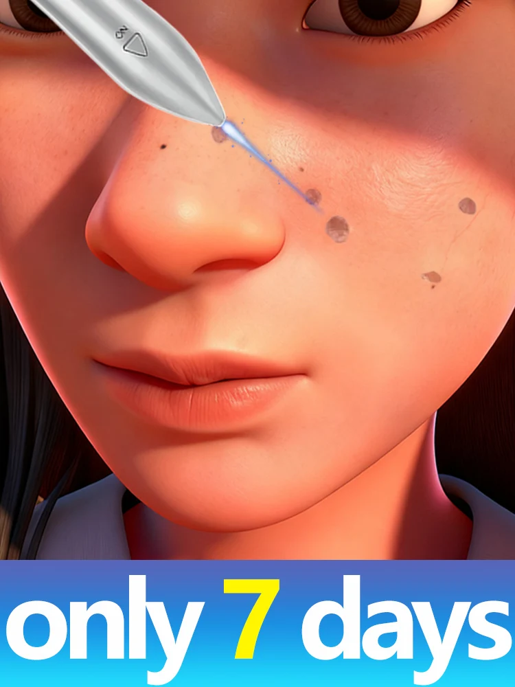 Синий лазерный инструмент для решения бородавок
Синий лазерный инструмент для решения бородавок