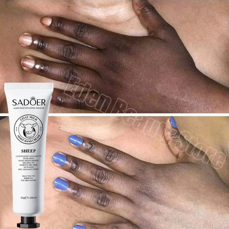 Dark Knuckles Fast Whitening Serum Anti Cracking Cream Pigmentation Correctors for Black Skin Intense Stains Remover Products
Dark Knuckles Fast Whitening Serum Anti Cracking Cream Pigmentation Correctors for Black Skin Intense Stains Remover Products