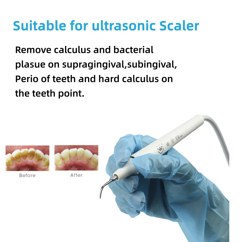 VV Dental Ultrasonic Scaler Tip High Quality Stainless Steel G1 G2 G3 G4 G5 G6 P1 P3
VV Dental Ultrasonic Scaler Tip High Quality Stainless Steel G1 G2 G3 G4 G5 G6 P1 P3