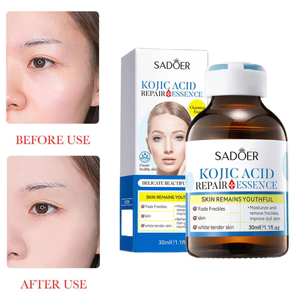 30g Boseine Kojic Acid Retinol Serum for Face Moisturizing Firming Hydrating Facial Essence Beauty Face Skin Care B3Y7
30g Boseine Kojic Acid Retinol Serum for Face Moisturizing Firming Hydrating Facial Essence Beauty Face Skin Care B3Y7