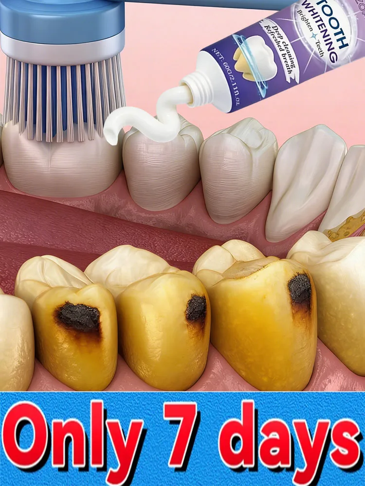 Eʀᴀᴅɪᴄᴀᴛᴇs Cᴀᴠɪᴛɪᴇs, Bᴏᴏsᴛs Tᴇᴇᴛʜ Wʜɪᴛᴇɴᴇss, Wɪᴘᴇs Aᴡᴀʏ Tᴏᴜɢʜ Sᴛᴀɪɴs
Eʀᴀᴅɪᴄᴀᴛᴇs Cᴀᴠɪᴛɪᴇs, Bᴏᴏsᴛs Tᴇᴇᴛʜ Wʜɪᴛᴇɴᴇss, Wɪᴘᴇs Aᴡᴀʏ Tᴏᴜɢʜ Sᴛᴀɪɴs