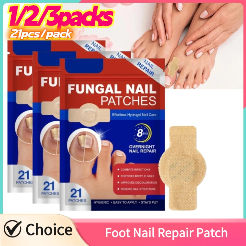 Foot Nail Repair Patches Nail Ingrown Correction Sticker Antifungals Toenail-Fungus Treatments Stickers Damaged Nail Care Tool
Foot Nail Repair Patches Nail Ingrown Correction Sticker Antifungals Toenail-Fungus Treatments Stickers Damaged Nail Care Tool