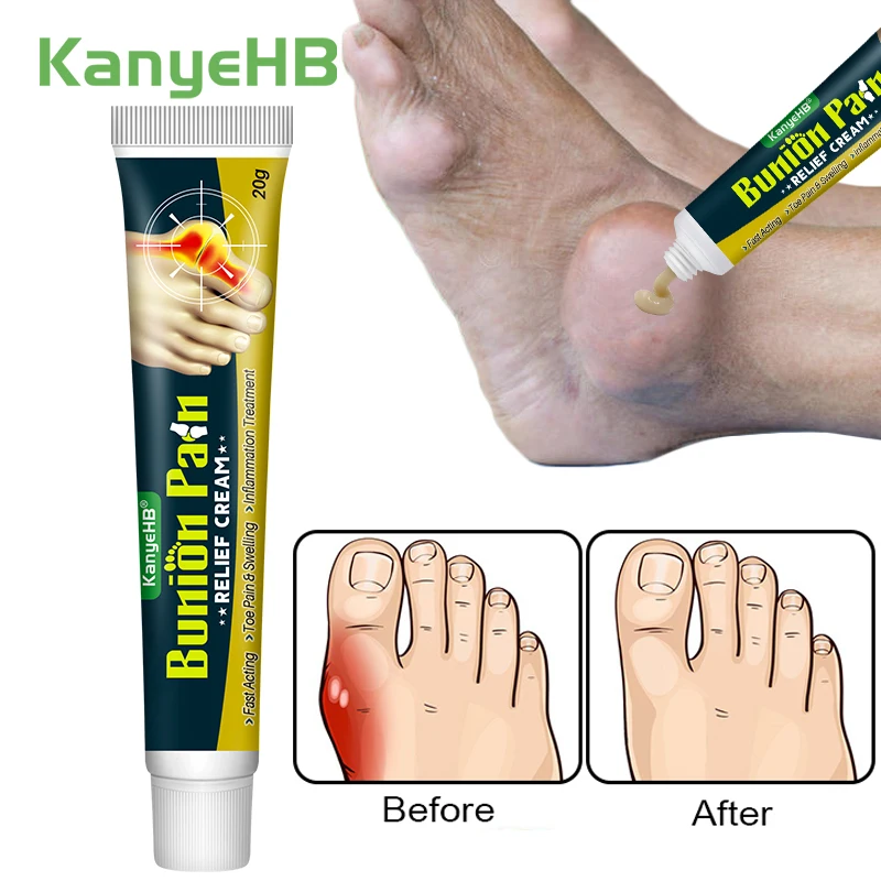 1Pcs Gout Treatment Cream Finger Toe Bunion Joint Pain Relief Herbal Medical Cream Foot Bone Thumb Corrector Care Ointment G049
1Pcs Gout Treatment Cream Finger Toe Bunion Joint Pain Relief Herbal Medical Cream Foot Bone Thumb Corrector Care Ointment G049
