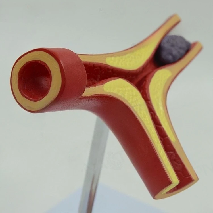 Artery model cardiovascular anatomy teaching model
Artery model cardiovascular anatomy teaching model