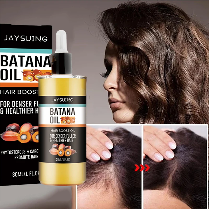 Набор для быстрого роста волос Батана Oil Traction Alopecia Маска для волос против выпадения волос Масло для роста волос Лечение облысения Уход за волосами
Набор для быстрого роста волос Батана Oil Traction Alopecia Маска для волос против выпадения волос Масло для роста волос Лечение облысения Уход за волосами